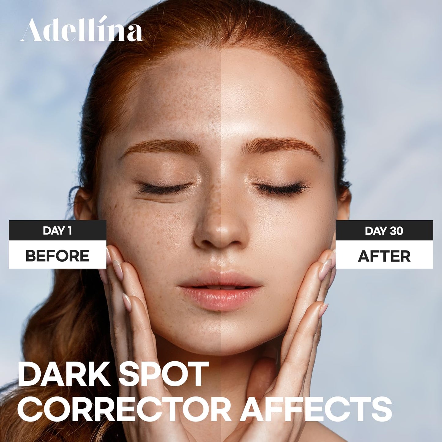 Dark Spot Remover for Face and Body Serum